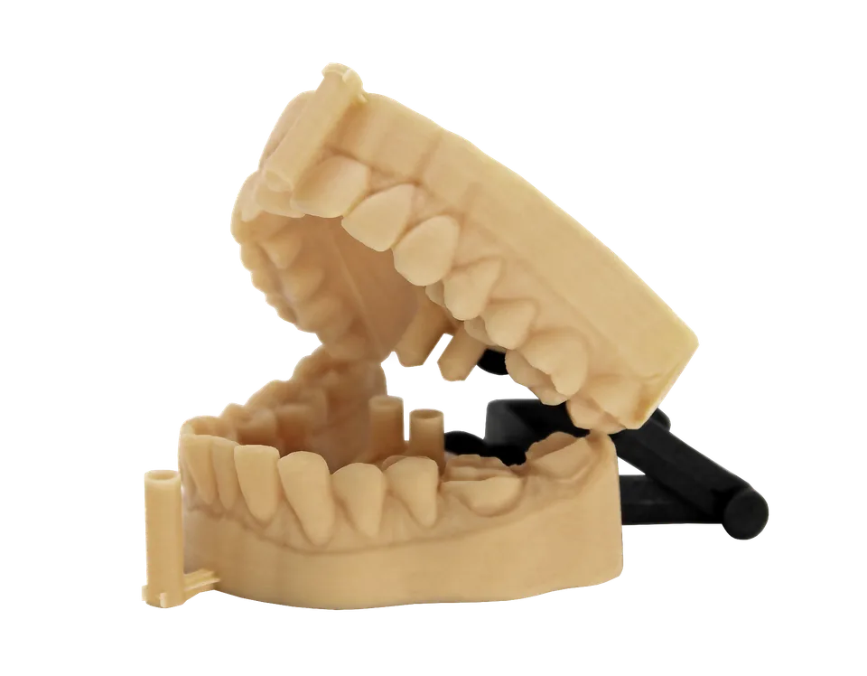 Dental model mounted on an articulator