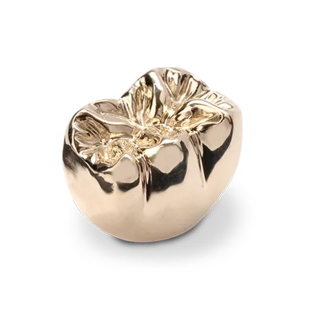 Example of a full-cast metal crown